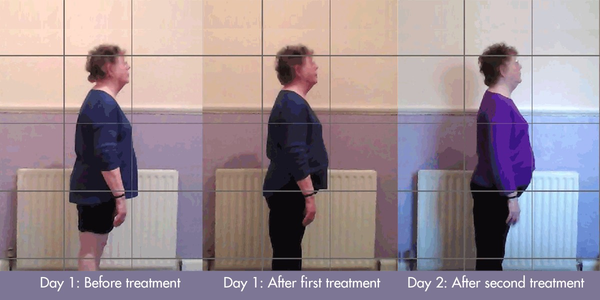 This photo shows three side images of the same woman, with a grid superimposed. In each picture, her posture gradually improves.