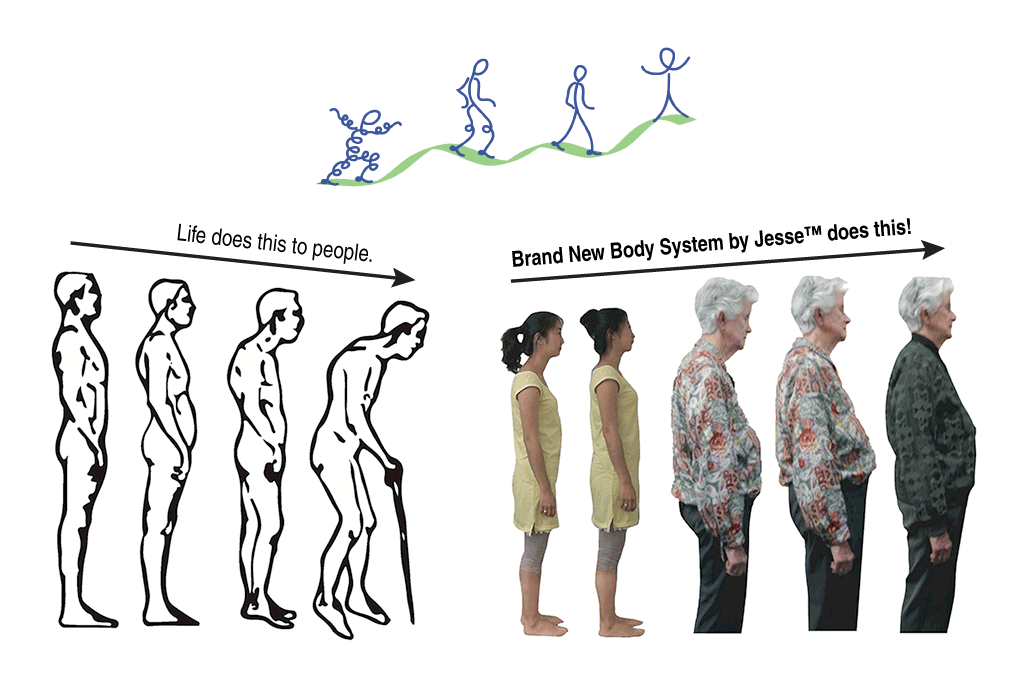 An illustrated person that starts out with good posture and gradually gets more bent and hunched. Real photographs of a young woman and an old woman show hunched posture before and straight posture after treatment.